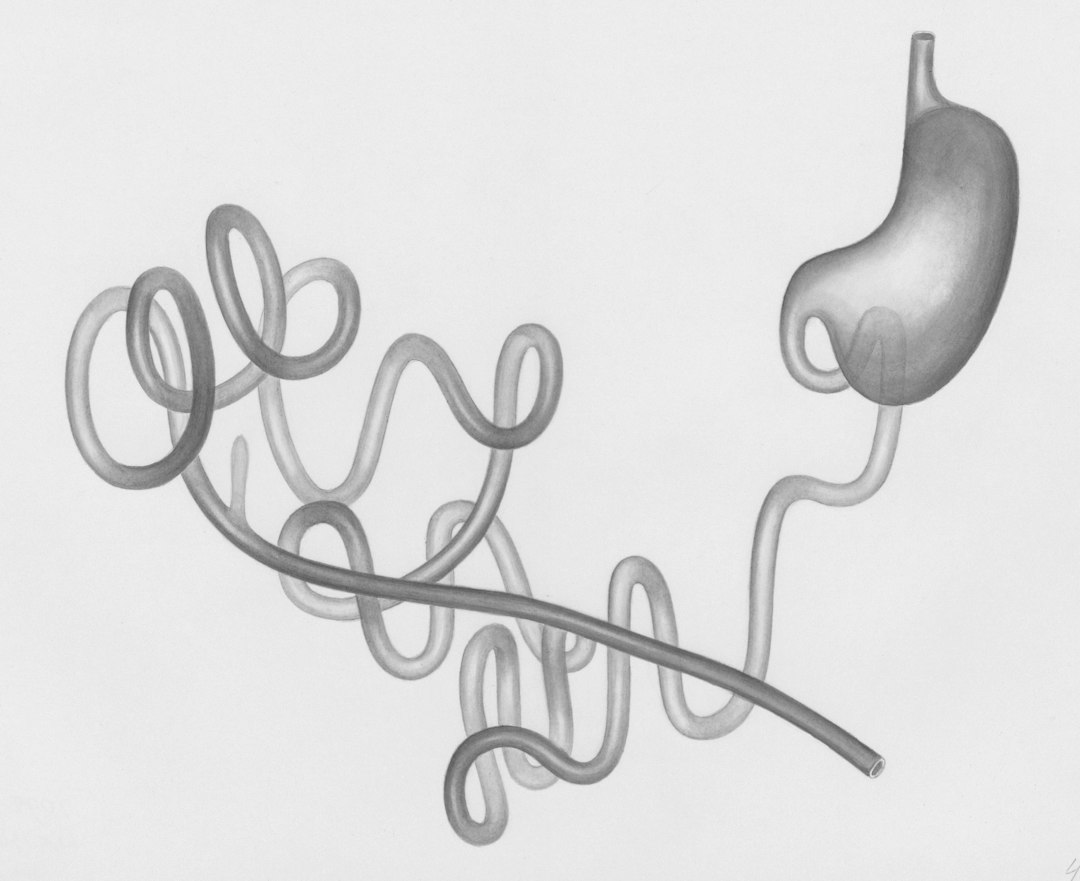 How Food Sensitivities Develop: The Connection Between Gut Health and Immune Response